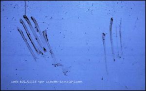 [trauma] code 80LJ1115